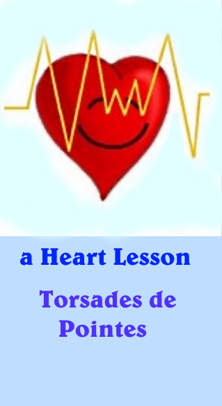 heart issues torsades de pointes